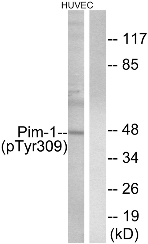 Rabbit Polyclonal Antibody to Pim-1 (Phospho-Tyr309)