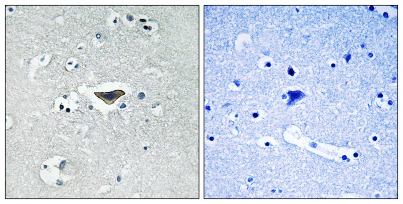 Rabbit Polyclonal Antibody to Ras-GRF1 (Phospho-Ser916)