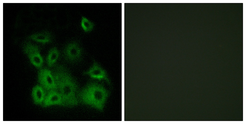 Rabbit Polyclonal Antibody to Bax (Phospho-Thr167)