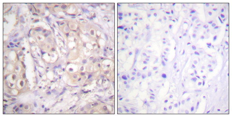 Rabbit Polyclonal Antibody to B-RAF (Phospho-Thr599)