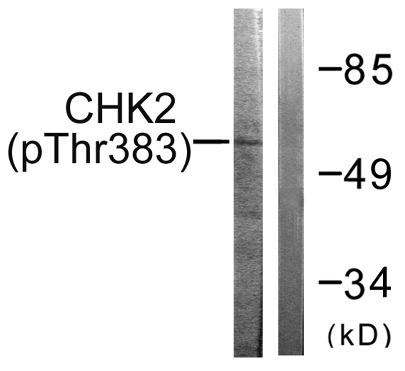Rabbit Polyclonal Antibody to Chk2 (Phospho-Thr383)