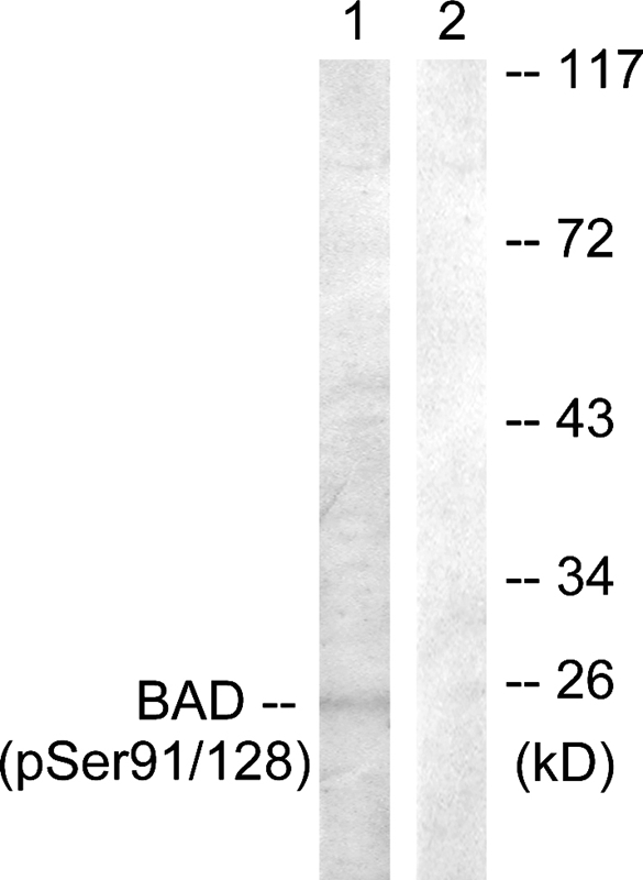 Rabbit Polyclonal Antibody to BAD (Phospho-Ser91/128)
