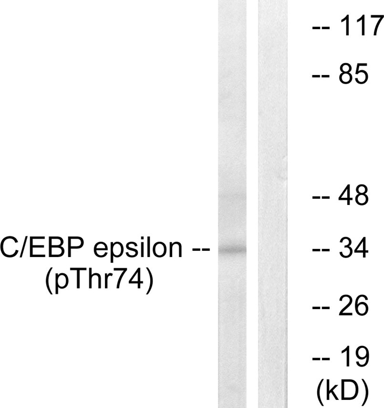 Rabbit Polyclonal Antibody to C/EBP-ε (Phospho-Thr74)