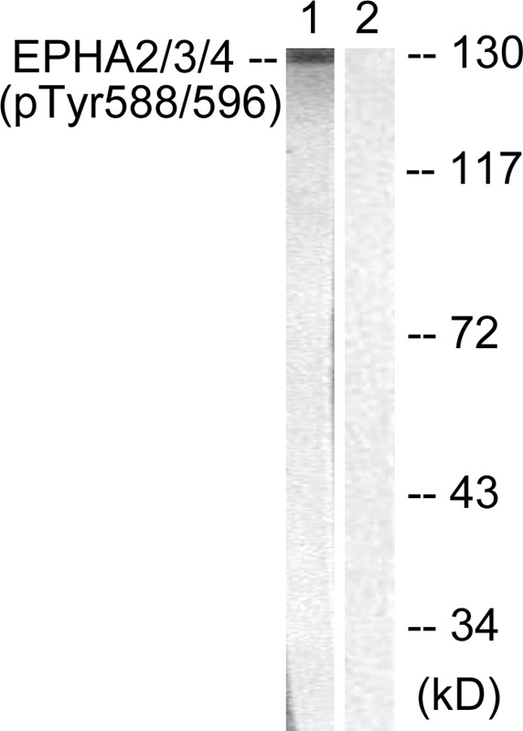 Rabbit Polyclonal Antibody to EPHA2/3/4 (Phospho-Tyr588/596)