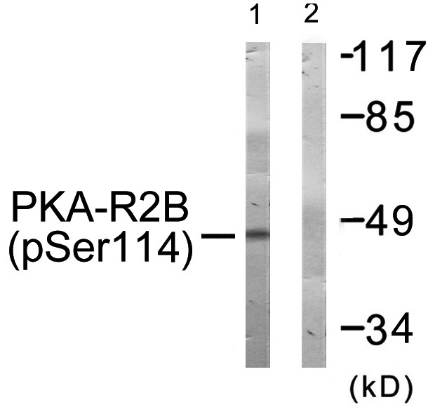 Rabbit Polyclonal Antibody to PKA-R2β (Phospho-Ser114)