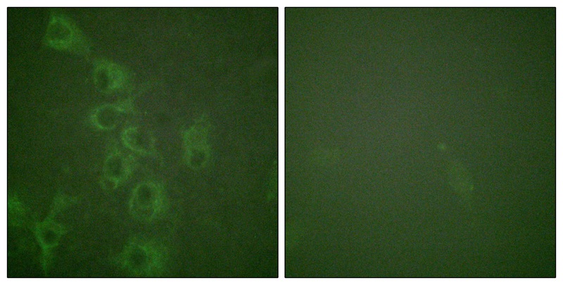 Rabbit Polyclonal Antibody to Histamine H1 Receptor (Phospho-Ser398)