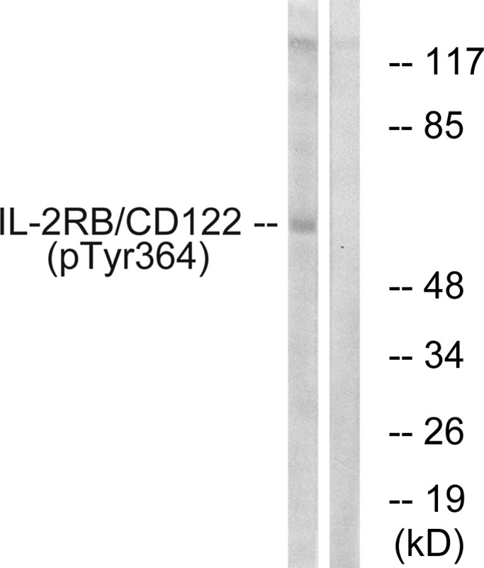 Rabbit Polyclonal Antibody to IL-2Rβ/CD122 (Phospho-Tyr364)