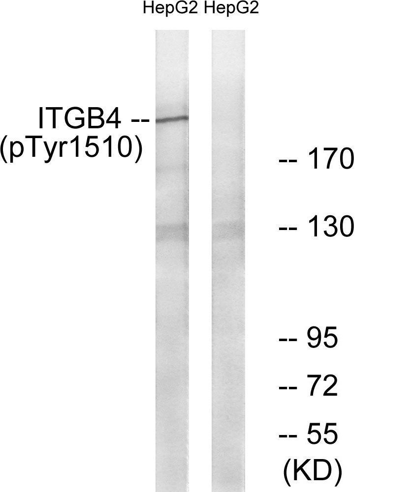 Rabbit Polyclonal Antibody to ITGB4 (Phospho-Tyr1510)