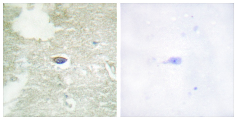 Rabbit Polyclonal Antibody to TGF β Receptor II (Phospho-Ser225/250)