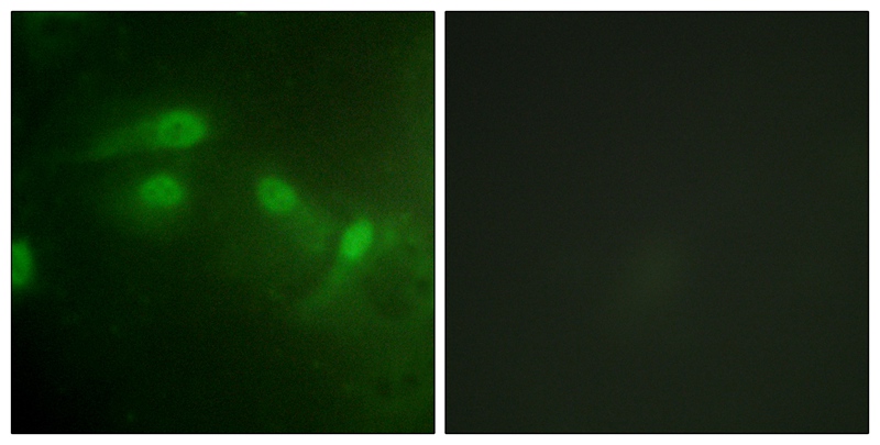 Rabbit Polyclonal Antibody to MDM2 (Phospho-Ser186/Ser188)