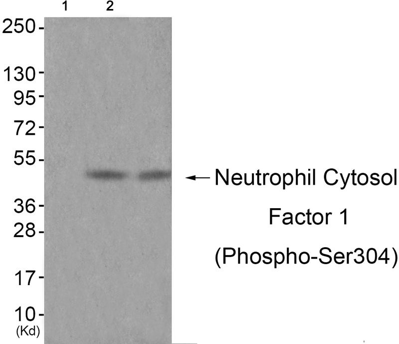 Rabbit Polyclonal Antibody to Neutrophil Cytosol Factor 1 (Phospho-Ser304)