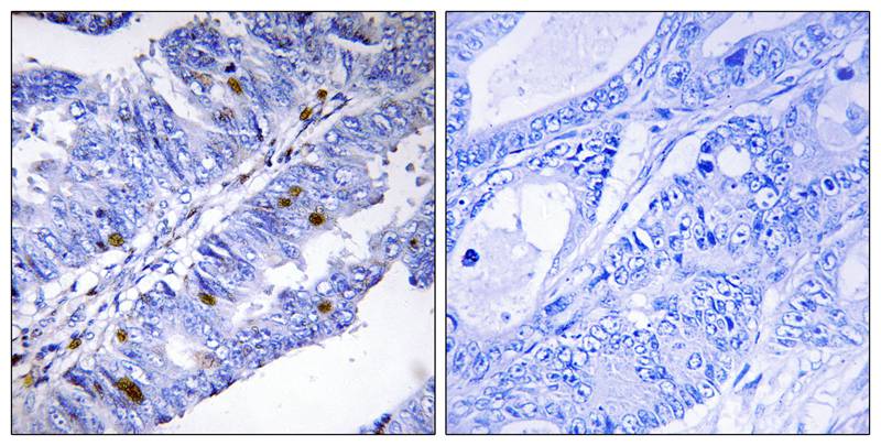Rabbit Polyclonal Antibody to Nuclear Receptor NR4A1 (Phospho-Ser351)