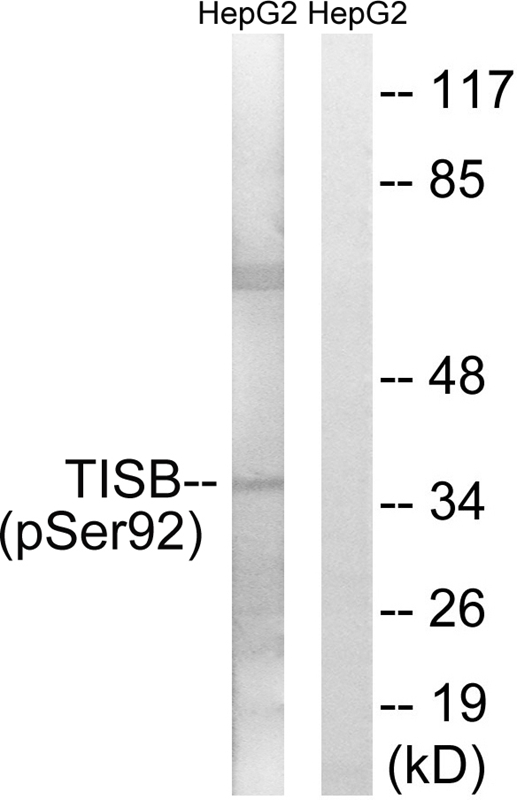 Rabbit Polyclonal Antibody to TISB (Phospho-Ser92)