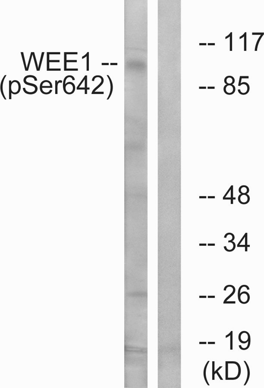 Rabbit Polyclonal Antibody to WEE1 (Phospho-Ser642)