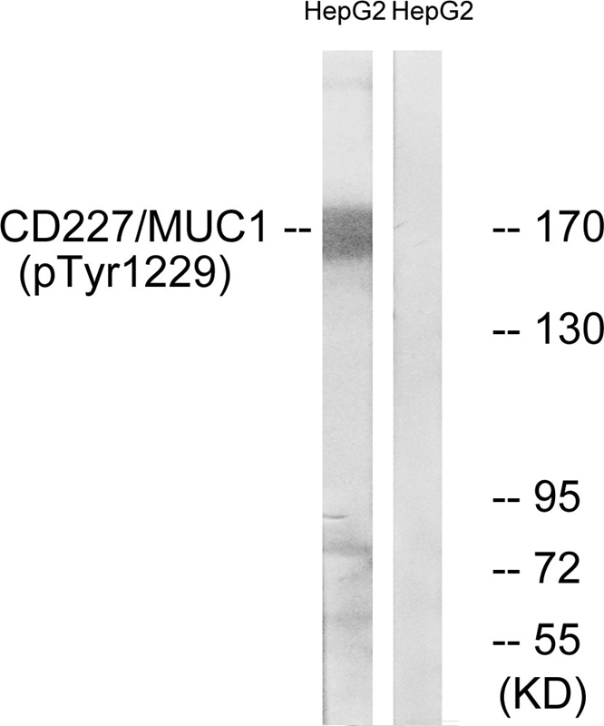Rabbit Polyclonal Antibody to CD227/MUC1 (Phospho-Tyr1229)