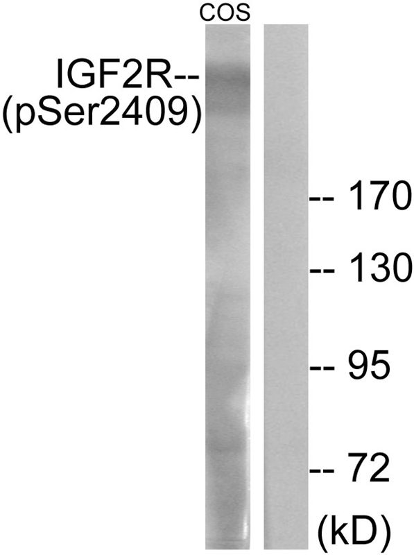 Rabbit Polyclonal Antibody to IGF2R (Phospho-Ser2409)