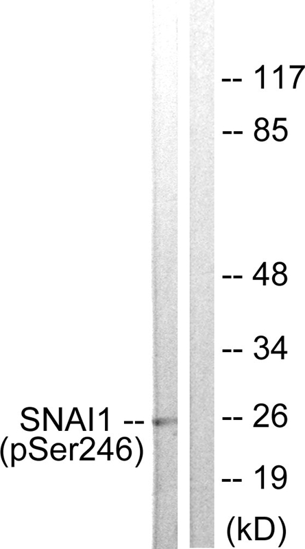 Rabbit Polyclonal Antibody to SNAI1 (Phospho-Ser246)