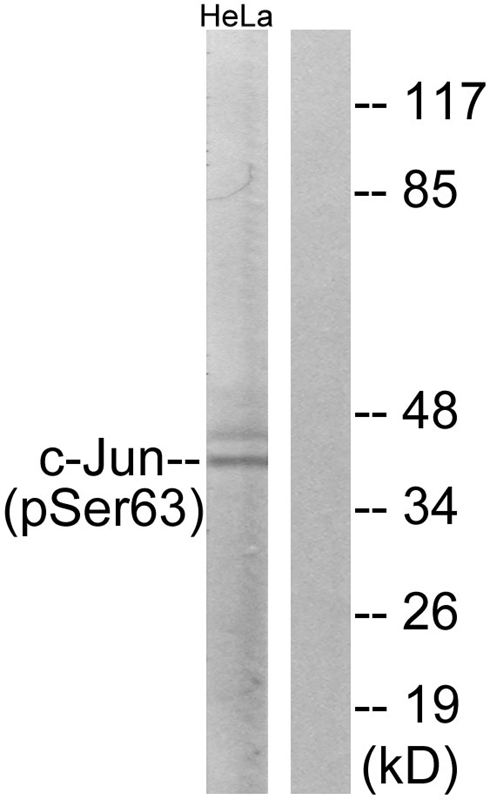 Rabbit Polyclonal Antibody to c-Jun (Phospho-Ser63)