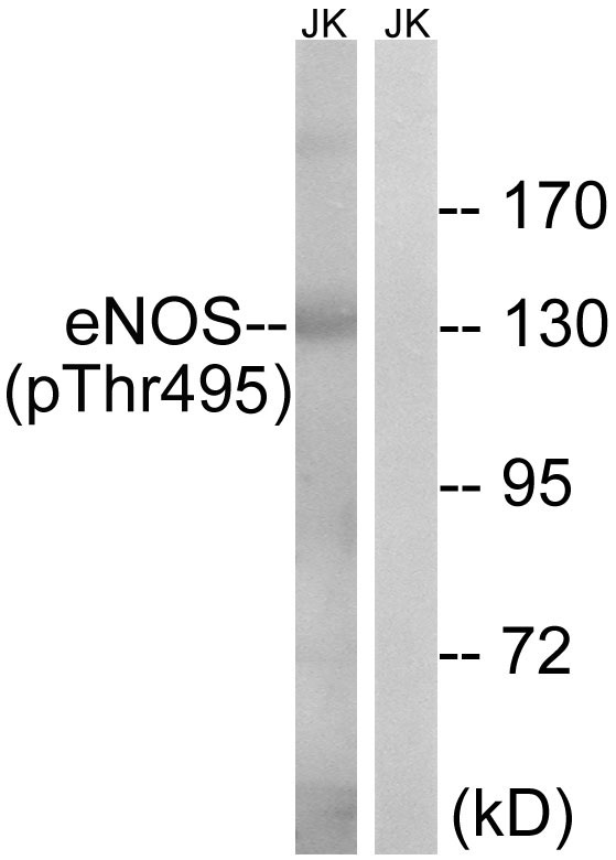 Rabbit Polyclonal Antibody to eNOS (Phospho-Thr495)