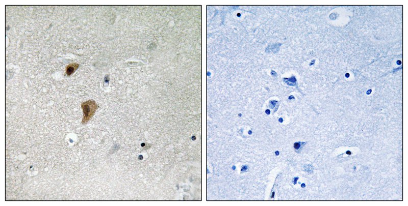 Rabbit Polyclonal Antibody to HSF1 (Phospho-Thr142)