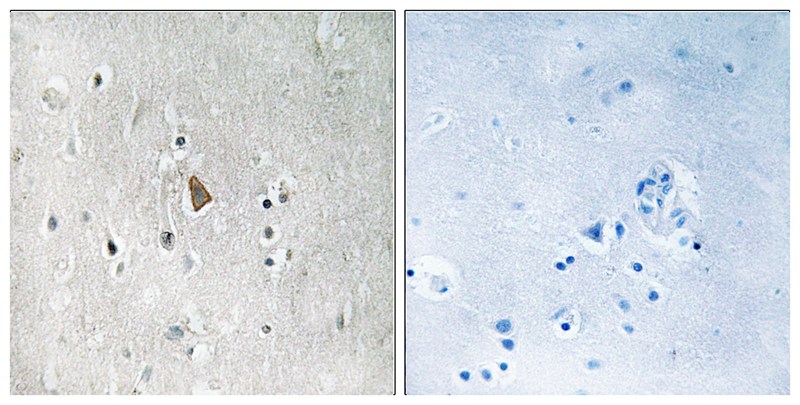 Rabbit Polyclonal Antibody to IGF1R (Phospho-Tyr1346)