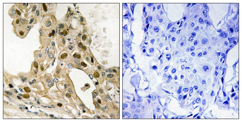 Rabbit Polyclonal Antibody to p53 (Phospho-Thr387)