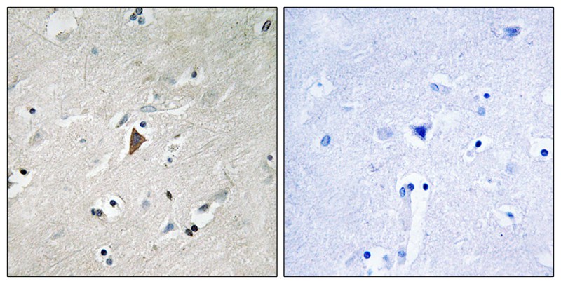 Rabbit Polyclonal Antibody to PDK1 (Phospho-Tyr9)