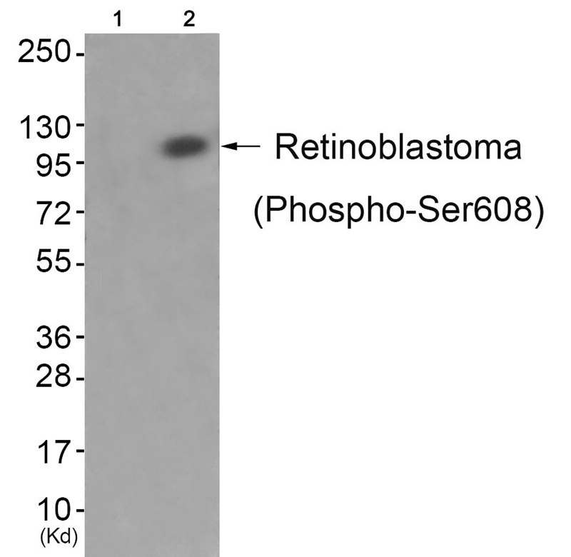 Rabbit Polyclonal Antibody to Retinoblastoma (Phospho-Ser608)