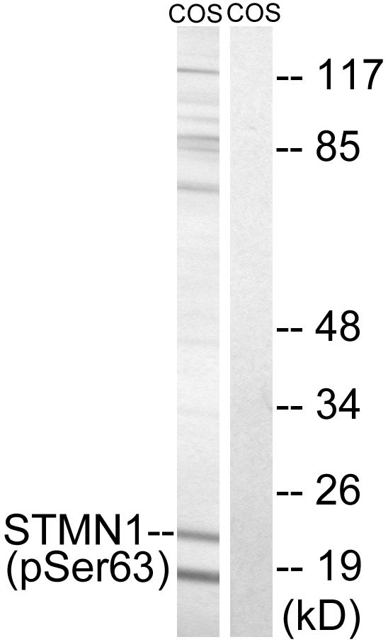 Rabbit Polyclonal Antibody to STMN1 (Phospho-Ser63)