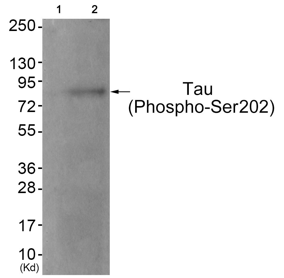 Rabbit Polyclonal Antibody to Tau (Phospho-Ser202)