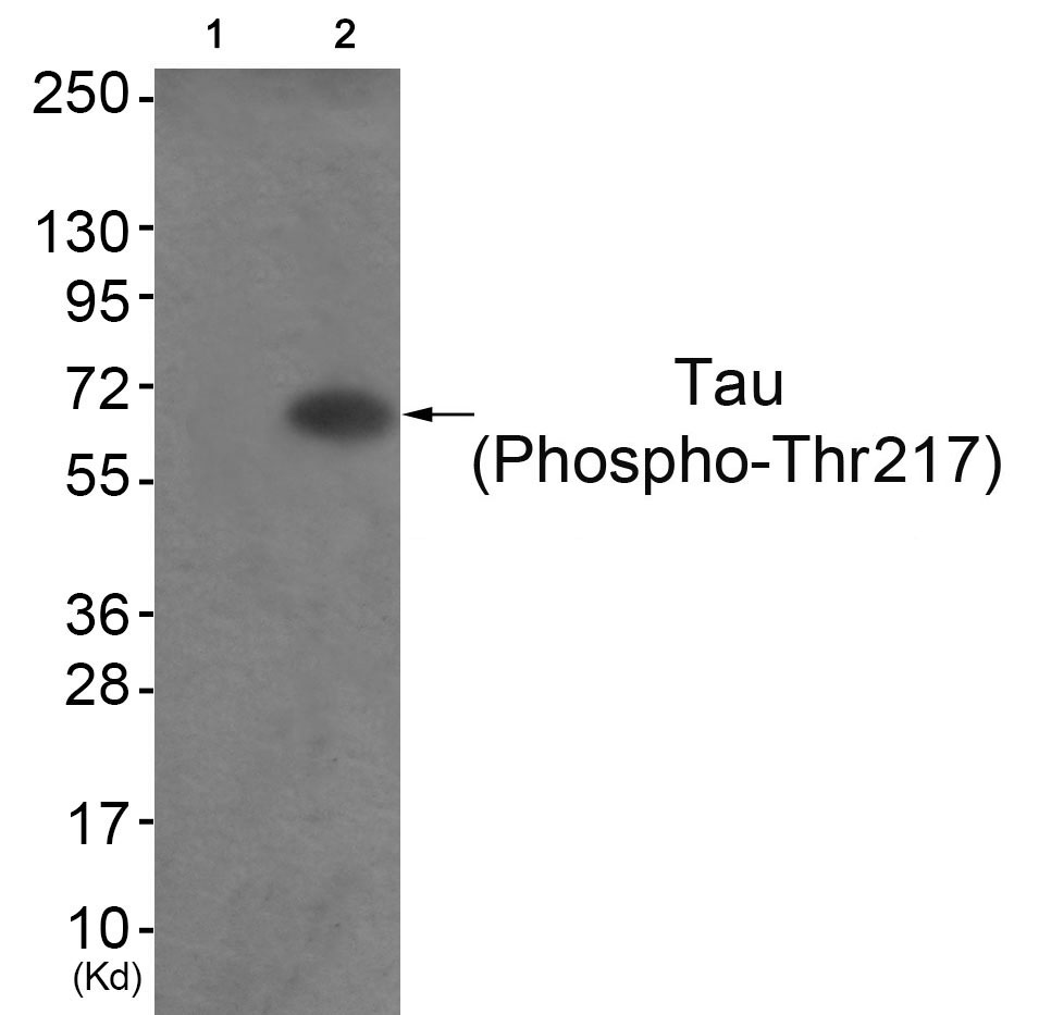 Rabbit Polyclonal Antibody to Tau (Phospho-Thr217)