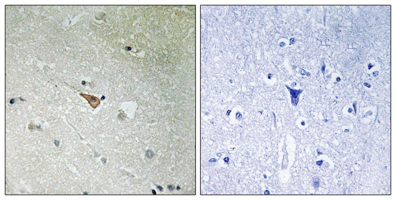 Rabbit Polyclonal Antibody to ALK (Phospho-Tyr1096)