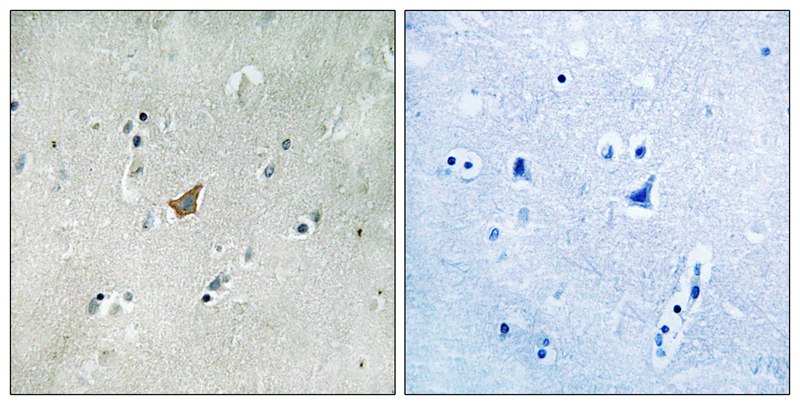 Rabbit Polyclonal Antibody to EPHA3/4/5 (Phospho-Tyr779/833)