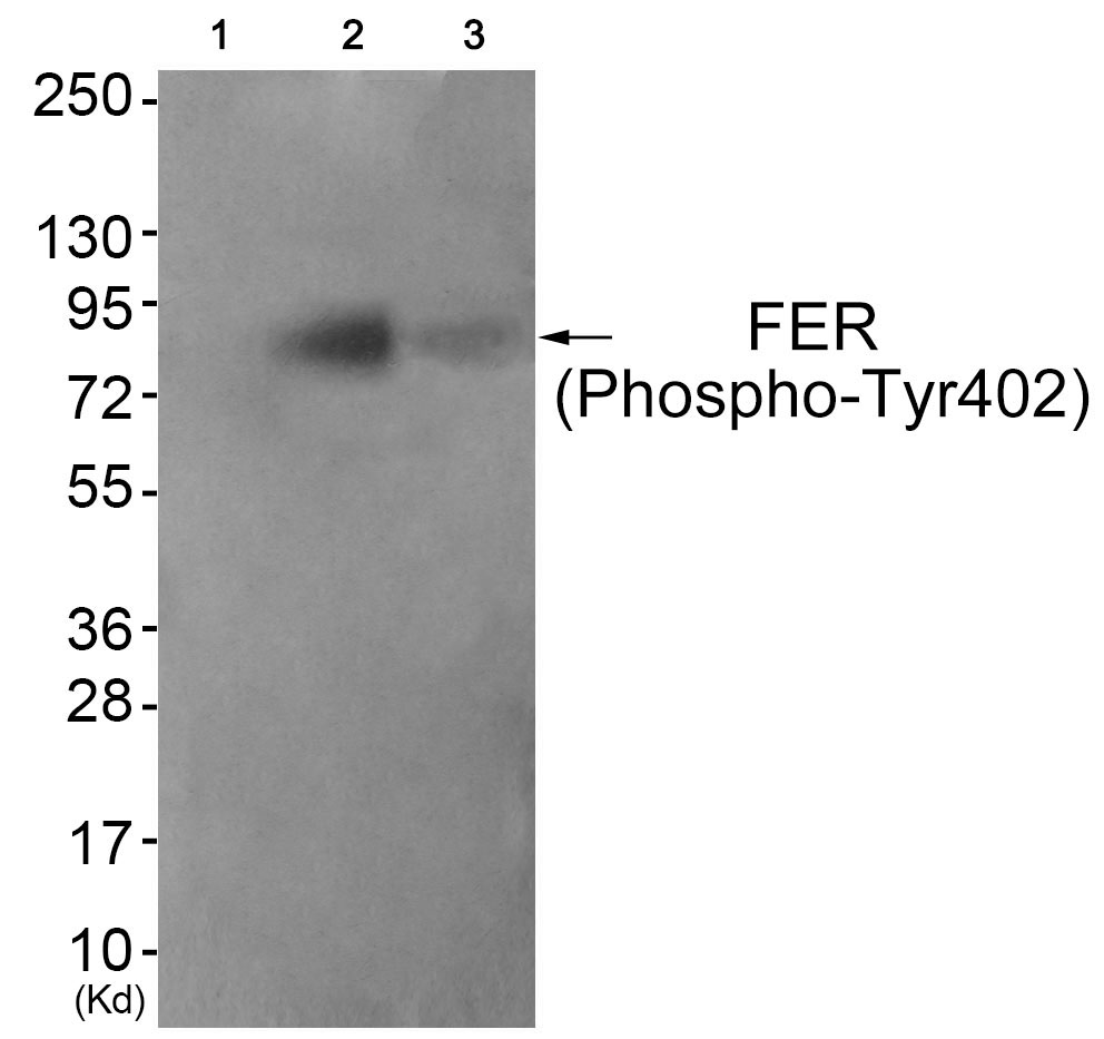 Rabbit Polyclonal Antibody to FER (Phospho-Tyr402)
