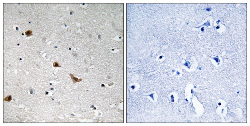 Rabbit Polyclonal Antibody to IKK-γ (Phospho-Ser376)