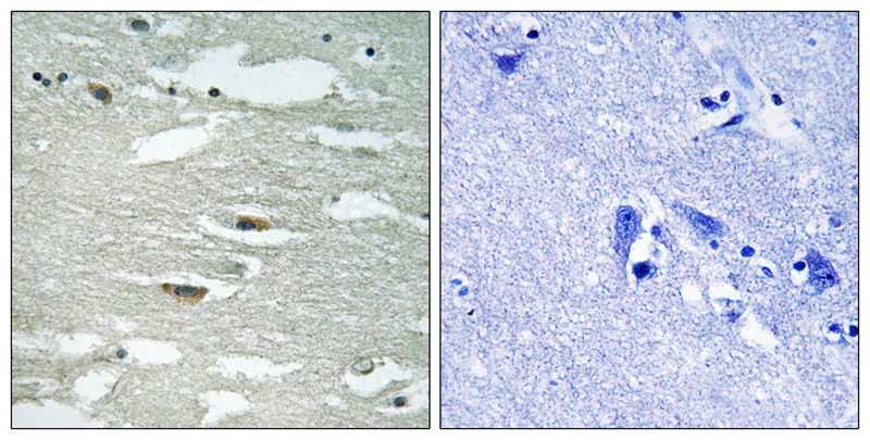 Rabbit Polyclonal Antibody to ILK (Phospho-Ser246)