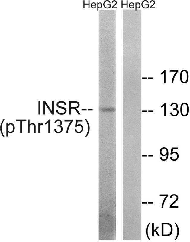 Rabbit Polyclonal Antibody to IR (Phospho-Thr1375)