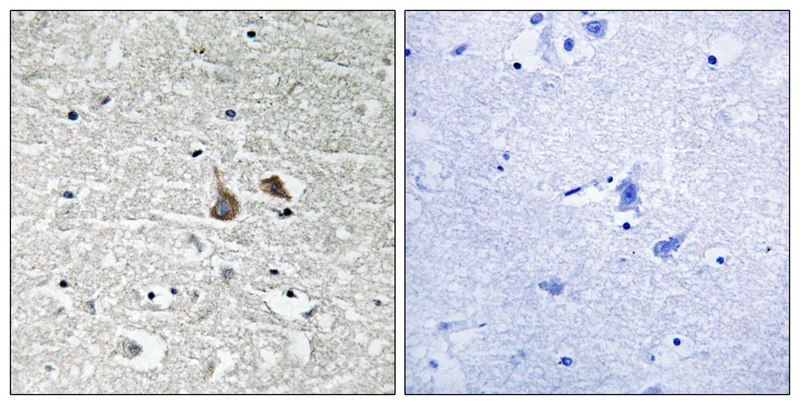 Rabbit Polyclonal Antibody to IRAK1 (Phospho-Ser376)