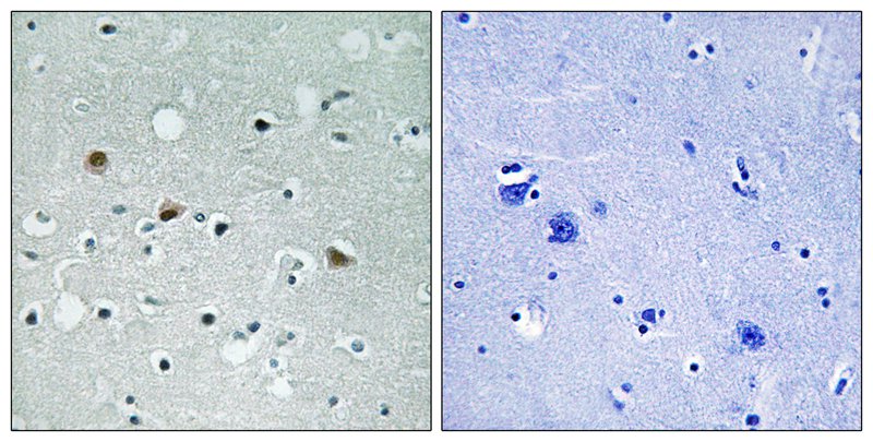 Rabbit Polyclonal Antibody to LATS1/2 (Phospho-Thr1079/1041)