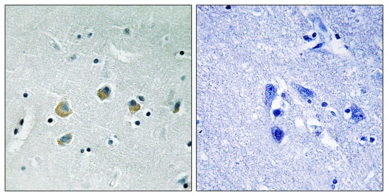Rabbit Polyclonal Antibody to MAP3K8 (Phospho-Ser400)