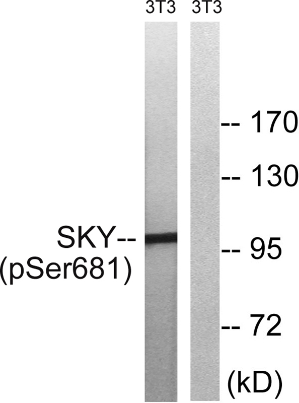 Rabbit Polyclonal Antibody to MER/SKY (Phospho-Tyr749/681)