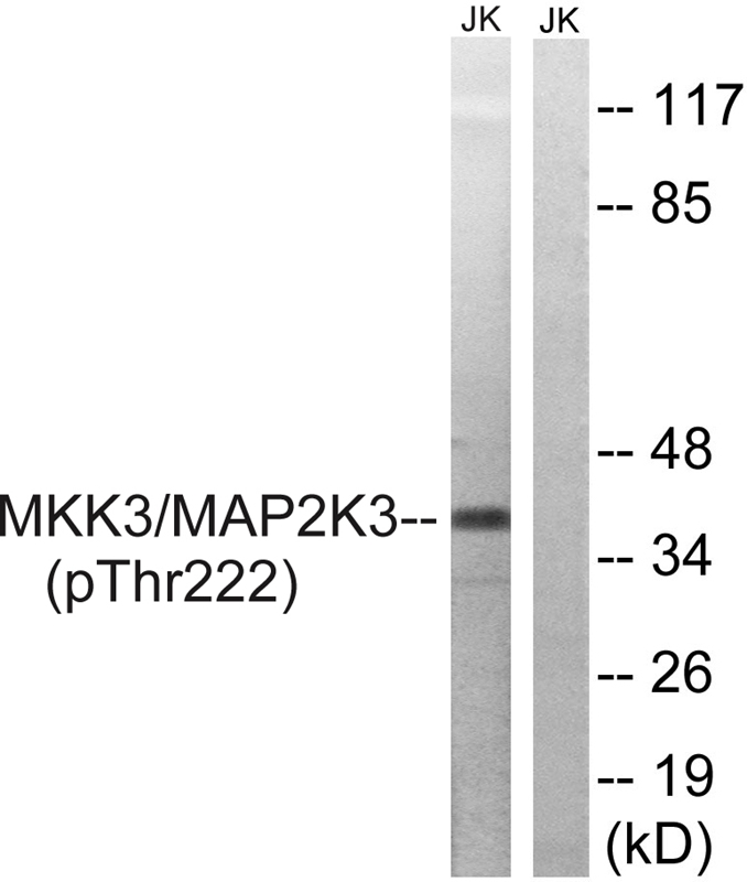 Rabbit Polyclonal Antibody to MAP2K3 (Phospho-Thr222)