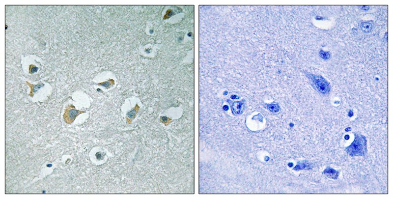 Rabbit Polyclonal Antibody to MLK1/2 (Phospho-Thr312/266)