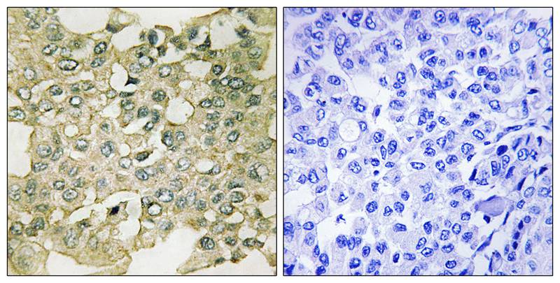 Rabbit Polyclonal Antibody to MYT1 (Phospho-Ser83)