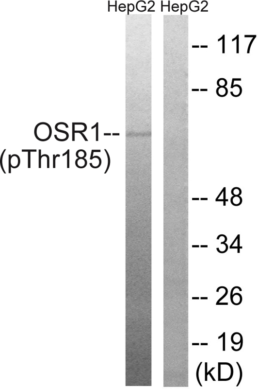 Rabbit Polyclonal Antibody to OSR1 (Phospho-Thr185)
