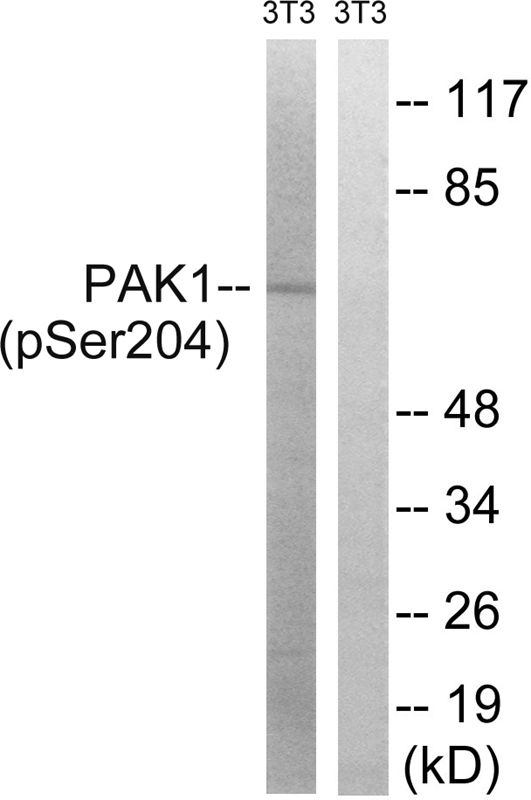 Rabbit Polyclonal Antibody to PAK1 (Phospho-Ser204)