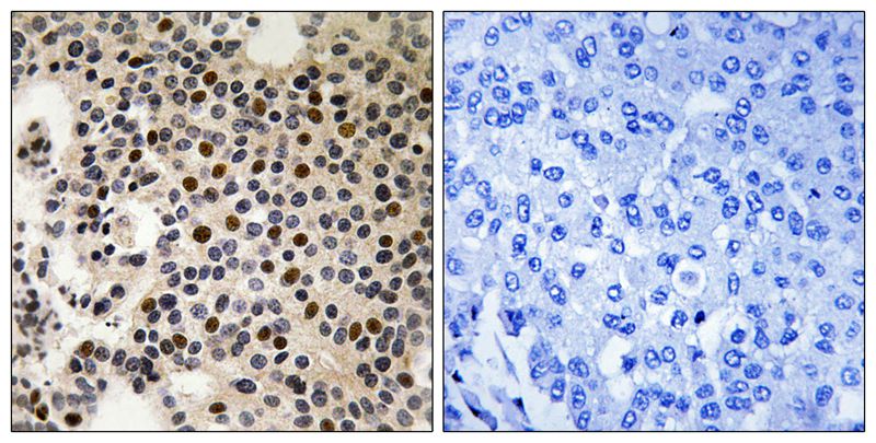 Rabbit Polyclonal Antibody to PAK2 (Phospho-Ser197)