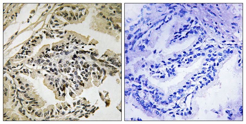 Rabbit Polyclonal Antibody to PEK/PERK (Phospho-Thr982)