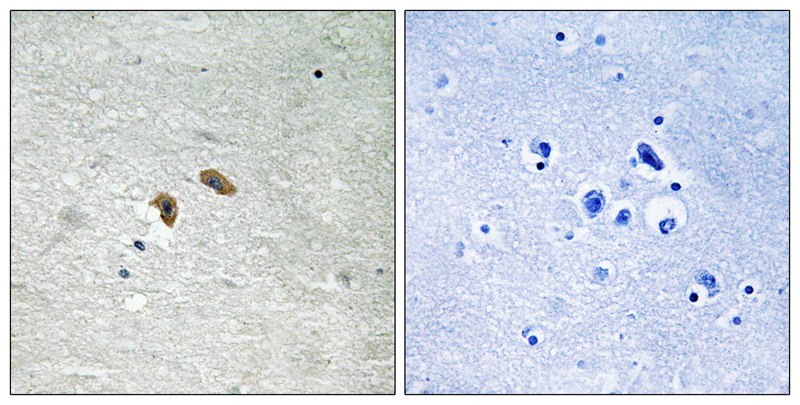 Rabbit Polyclonal Antibody to C-RAF (Phospho-Thr269)