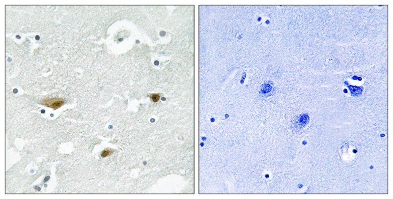 Rabbit Polyclonal Antibody to STK39 (Phospho-Ser323)